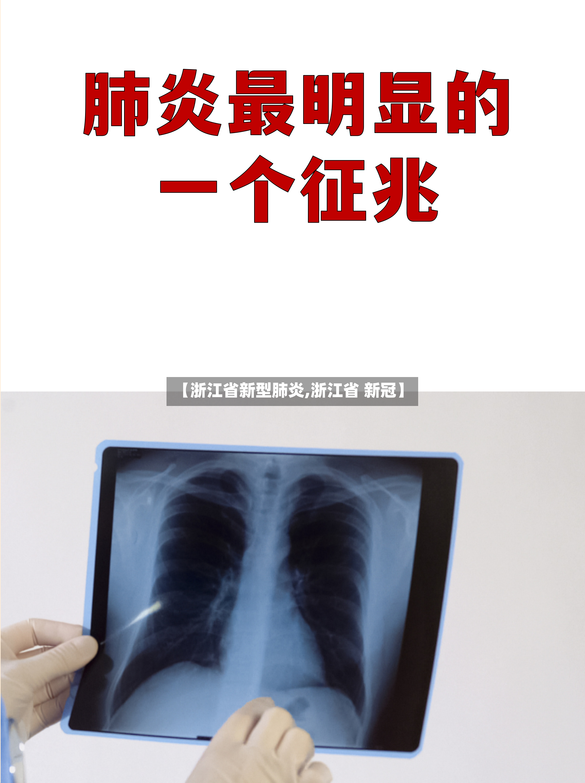 【浙江省新型肺炎,浙江省 新冠】-第3张图片