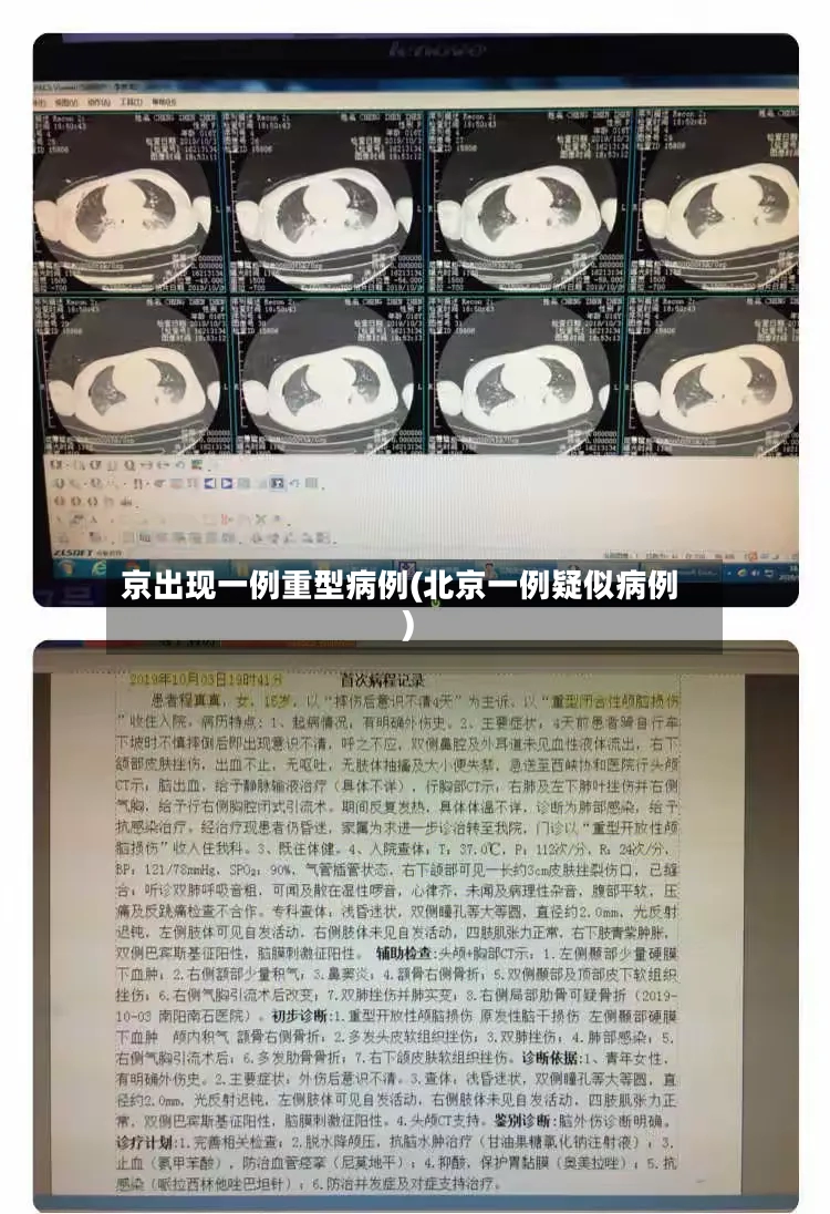 京出现一例重型病例(北京一例疑似病例)-第3张图片
