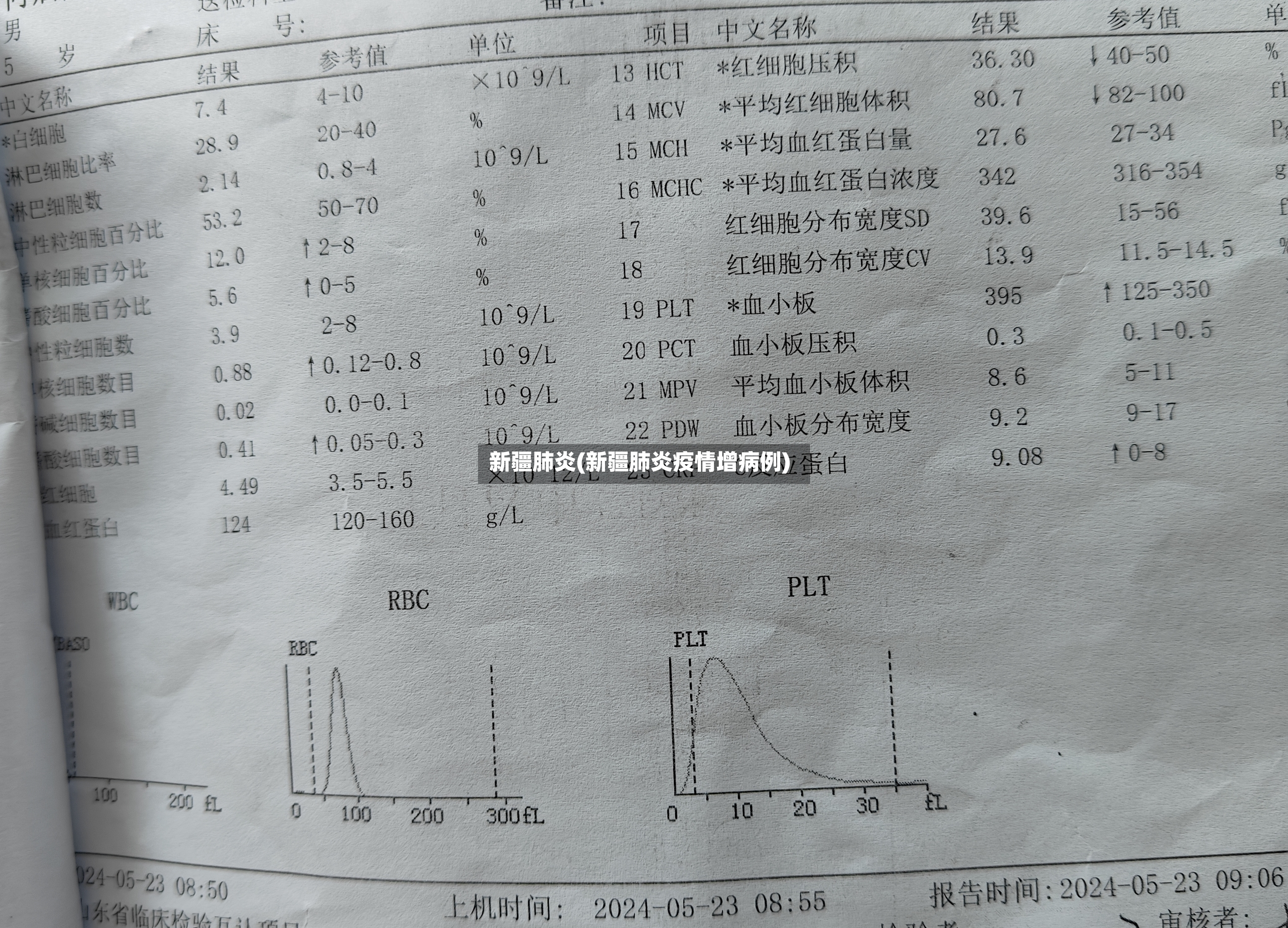 新疆肺炎(新疆肺炎疫情增病例)-第2张图片