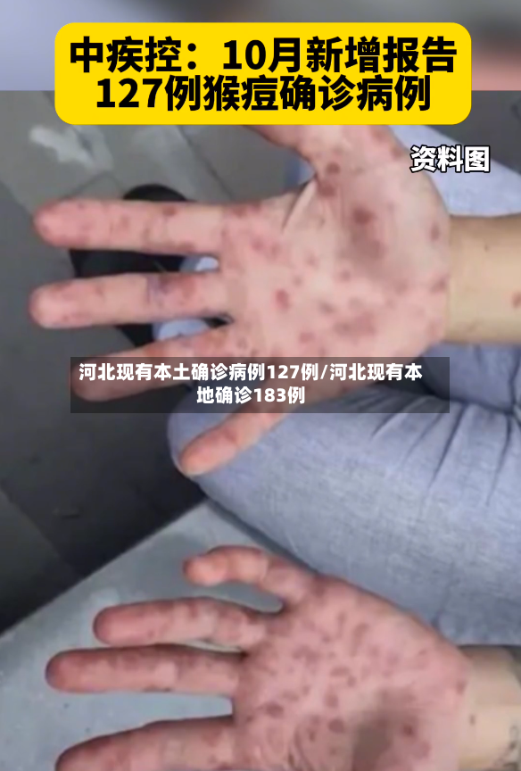 河北现有本土确诊病例127例/河北现有本地确诊183例-第2张图片