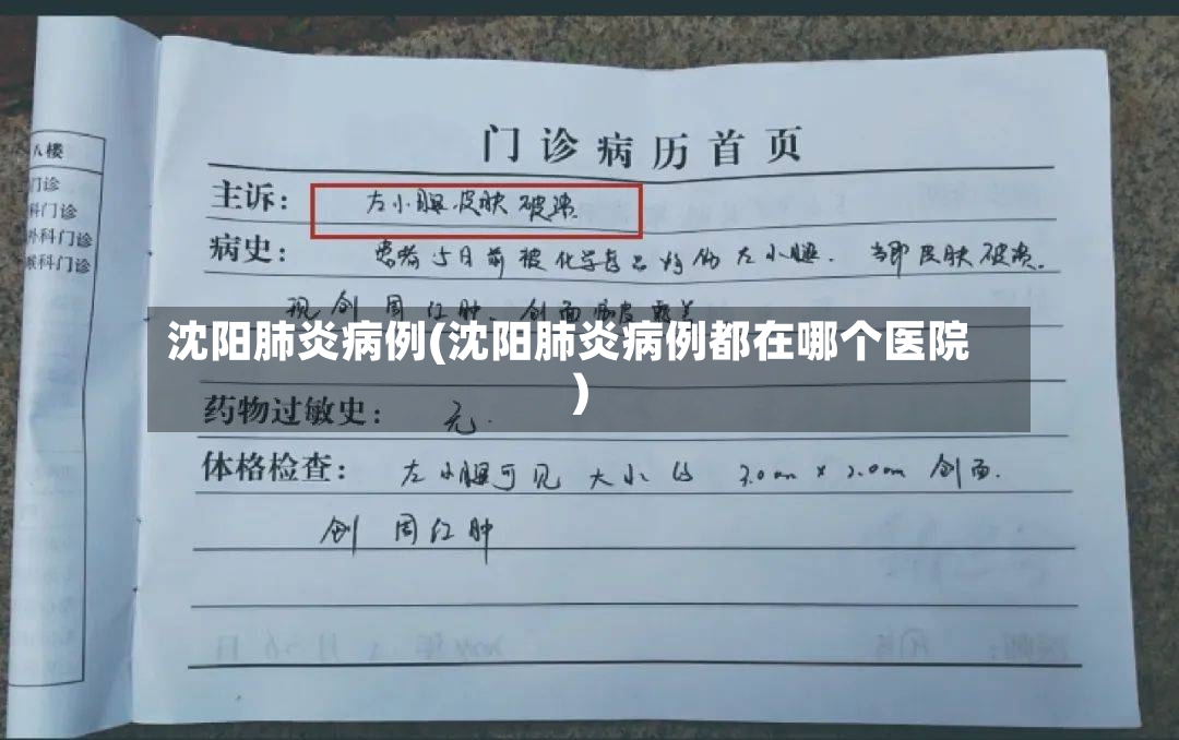 沈阳肺炎病例(沈阳肺炎病例都在哪个医院)-第3张图片